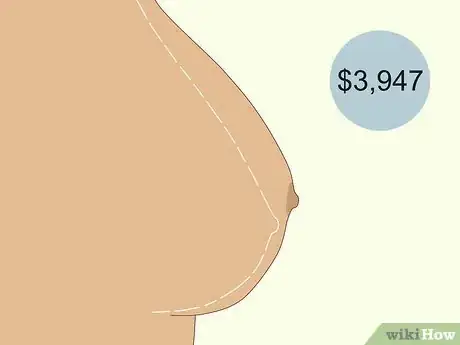 Image titled Have Plastic Surgery Step 8