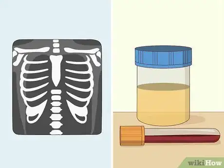 Image titled Detect Brain Cancer Step 13