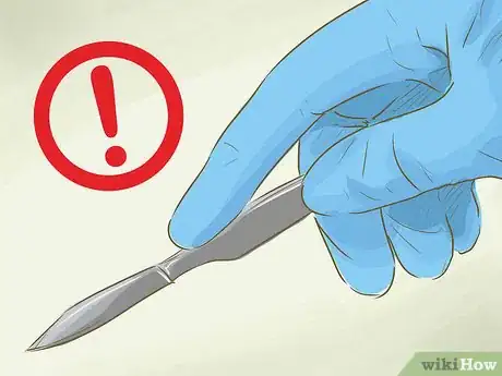 Image titled Treat an Aneurysm Step 3