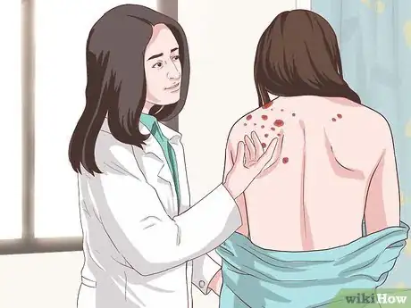 Image titled Handle a Rheumatoid Arthritis Skin Problem Step 5