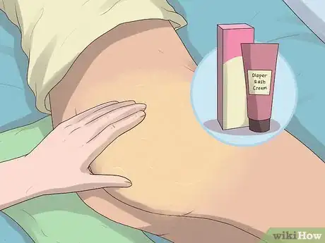 Image titled Change a Cloth Adult Diaper Step 16