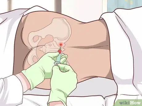 Image titled Diagnose Fanconi Anemia Step 16