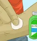 Stop Scratching a Mosquito Bite