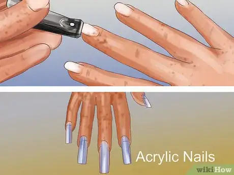 Image titled Stop Dermatillomania Step 12