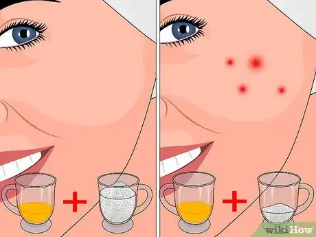 Image titled Remove Dead Skin Using Sugar Step 3