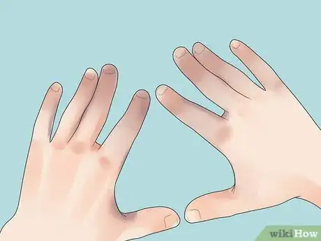 Image titled Prevent Frostbite Step 22