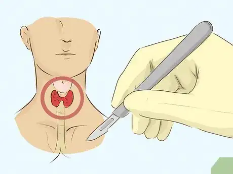 Image titled Treat Hyperthyroidism in Men Step 11