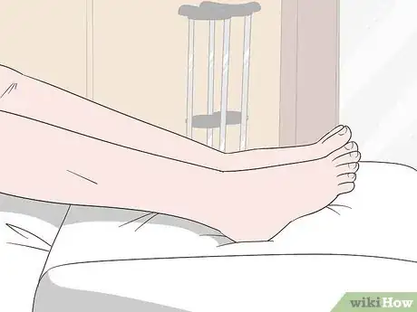 Image titled Treat Syndesmosis Step 1