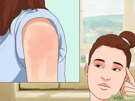 Image titled Determine the Side Effects of an MMR Vaccination Step 4