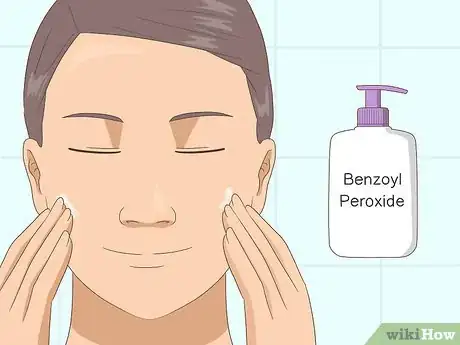 Image titled Cure Oily Skin Step 1
