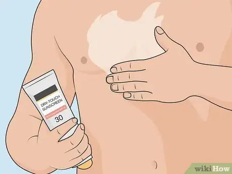 Image titled Control Psoriasis Step 08