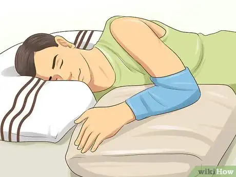 Image titled Treat a Growth Plate Fracture Step 10