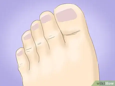 Image titled Get Rid of Side Cramps Step 6