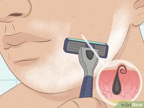 Image titled Shave with a Five Blade Razor Step 5