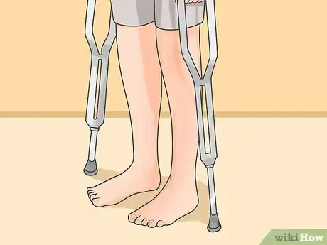 Image titled Avoid Heel Pain and Plantar Fasciitis Step 13