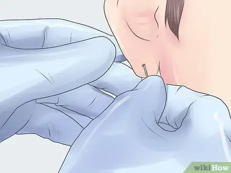 Image titled 205412 16