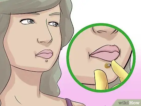 Image titled Take Out a Monroe Piercing Step 3