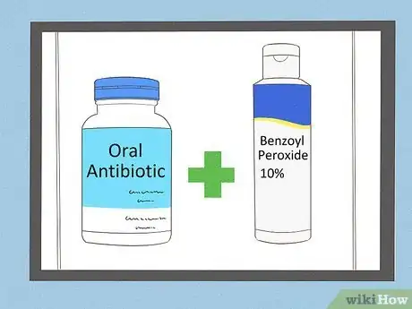 Image titled Get Rid of Acne if You Have Fair Skin Step 6