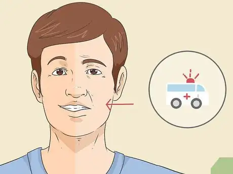 Image titled Treat Droopy Eyelids Step 4