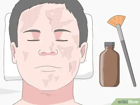 Image titled Cure Oily Skin Step 15