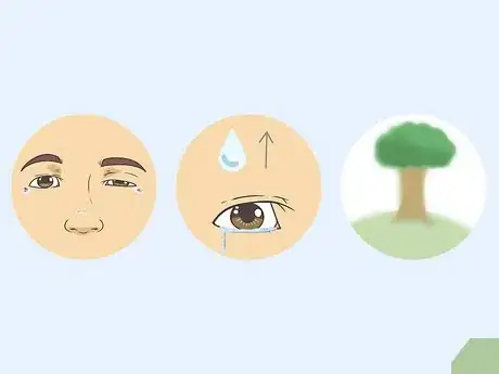 Image titled Treat Droopy Eyelids Step 7