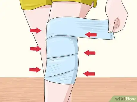 Image titled Treat a Growth Plate Fracture Step 12