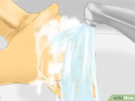 Image titled Diagnose Typhoid Fever Step 8