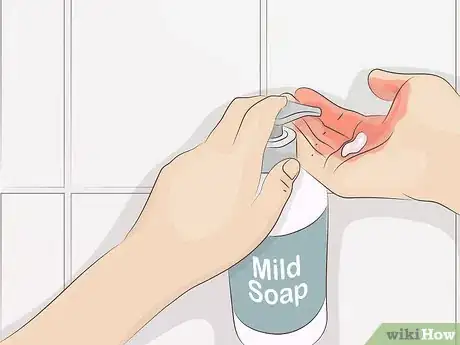 Image titled Remove Acrylic Paint from Skin Step 3