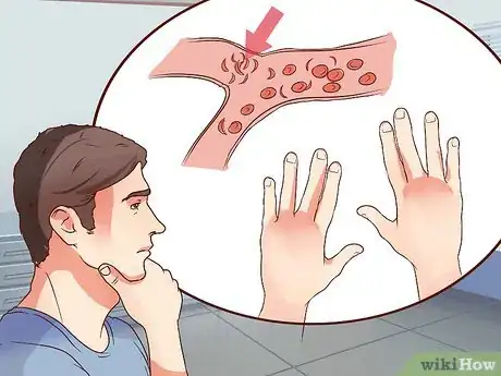 Image titled Identify Stroke Symptoms As a Young Adult Step 14