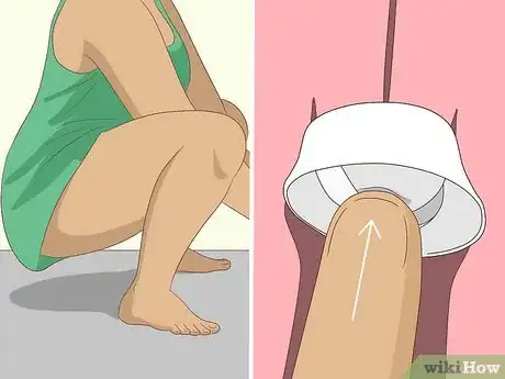 Image titled Use a Cervical Cap Step 8