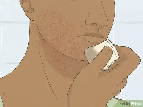 Image titled Get Rid of Razor Burn Fast Step 4