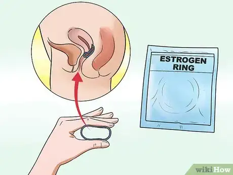 Image titled Stop Vaginal Itching Step 18