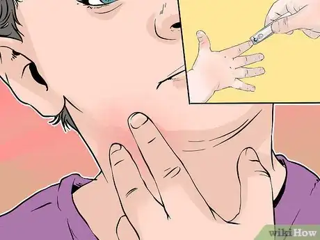 Image titled Treat Eczema in Children Step 6