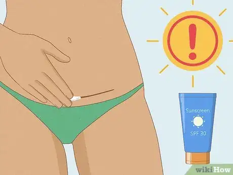 Image titled Lighten a C‐Section Scar Step 3