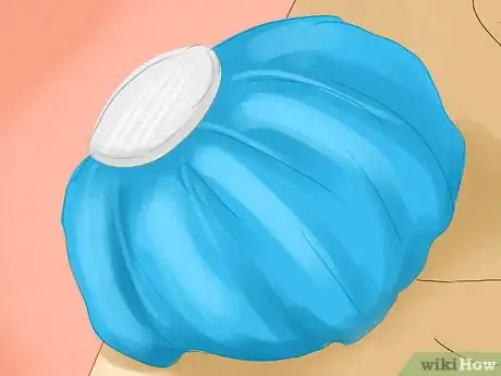 Image titled Ease Pain Caused by a Stress Fracture Step 5