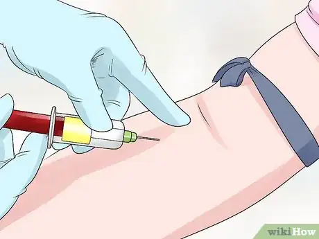 Image titled Diagnose Bell's Palsy Step 8