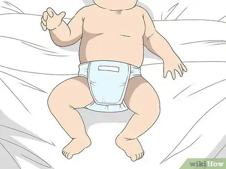 Image titled Diagnose Spinal Muscular Atrophy Step 2