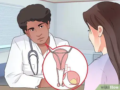 Image titled Treat Cervical Cancer Step 3