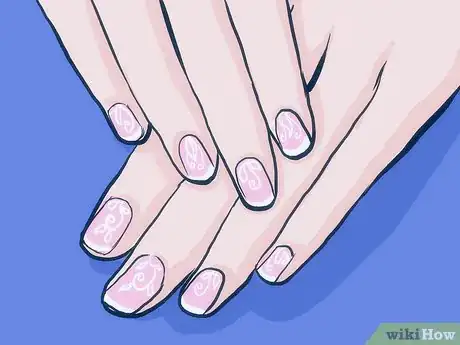 Image titled Stop Biting Your Nails Step 23