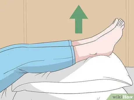 Image titled Treat Syndesmosis Step 4