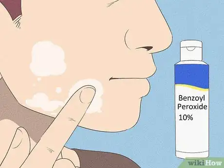 Image titled Get Rid of Acne if You Have Fair Skin Step 17