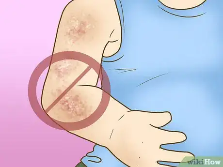 Image titled Regulate Gut Bacteria in Kids Step 13