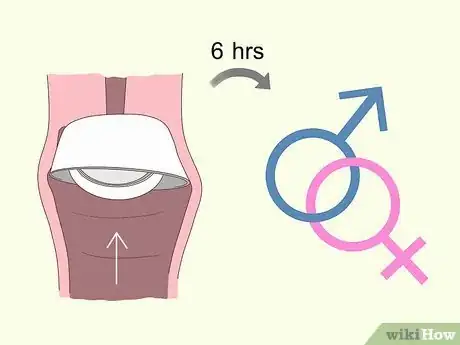 Image titled Use a Cervical Cap Step 6