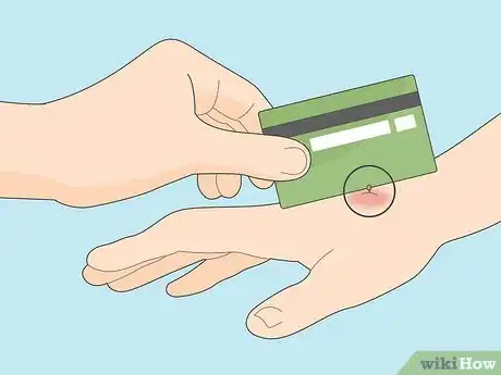 Image titled Treat a Wasp or Hornet Sting Step 1