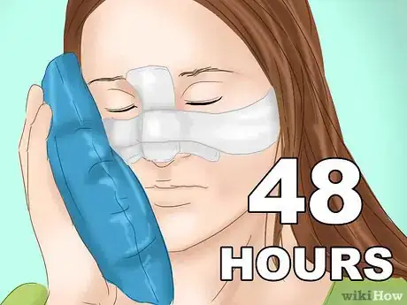 Image titled Prevent Bruising After Plastic Surgery Step 8