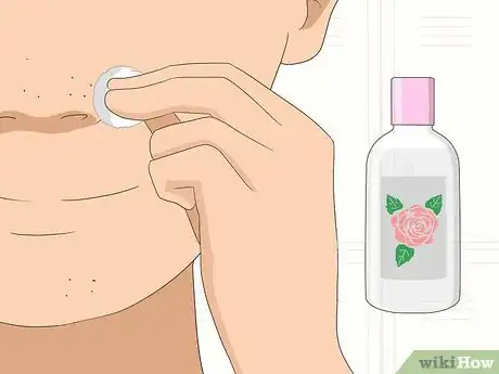 Image titled Clean Clogged Pores Step 17