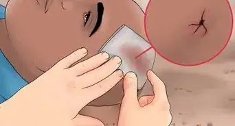 Evaluate for Head Injuries During First Aid