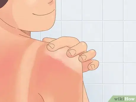 Image titled Use Emu Oil for Health and Skin Benefits Step 3