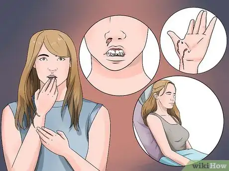 Image titled Eat More Vitamin C Step 4