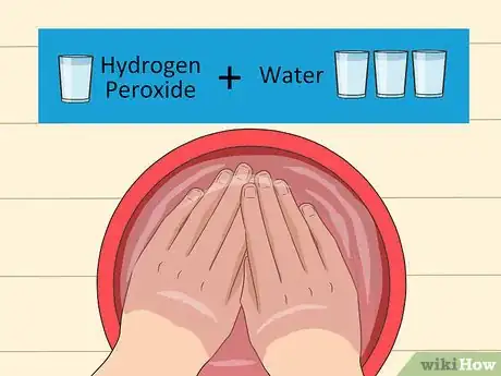 Image titled Get a Bad Smell off Your Hands Step 10